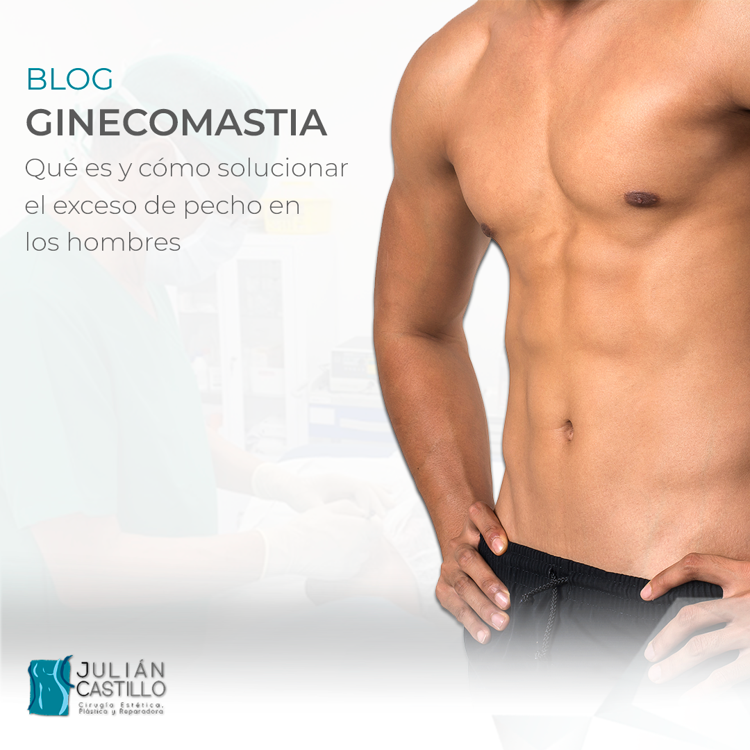 Ginecomastia: qué es y cómo solucionar el exceso de pecho en los hombres
