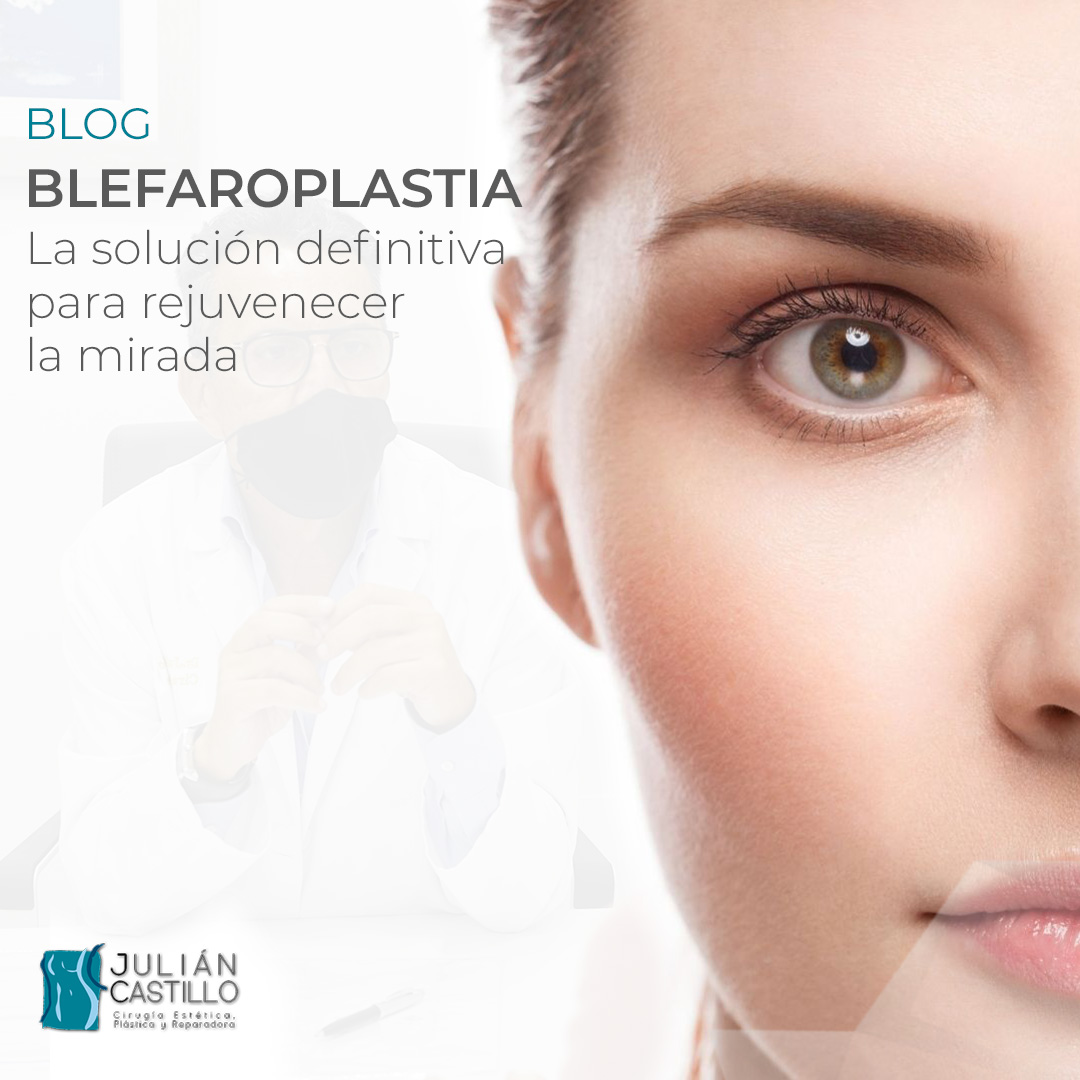 Blefaroplastia o cirugía de párpados: La solución definitiva para rejuvenecer la mirada