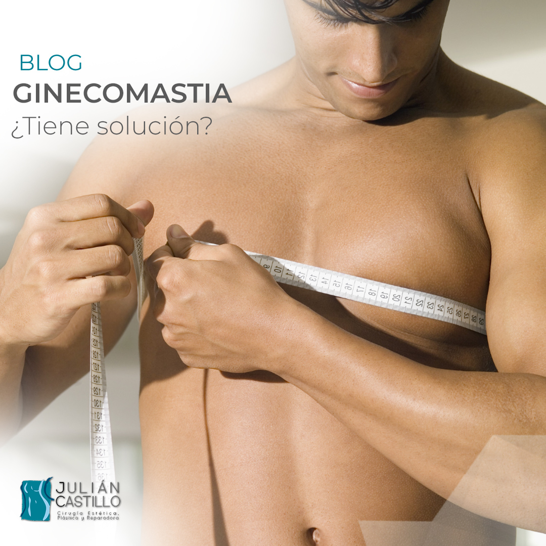 Ginecomastia o agrandamiento mamario en hombres: ¿Tiene solución?